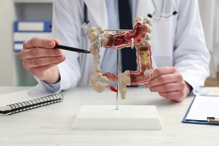 Hernia Treatment